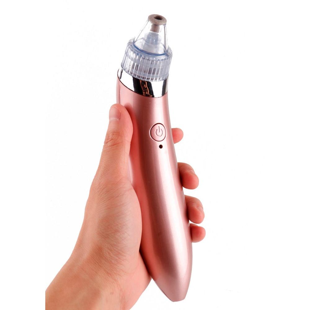 Electric blackhead remover