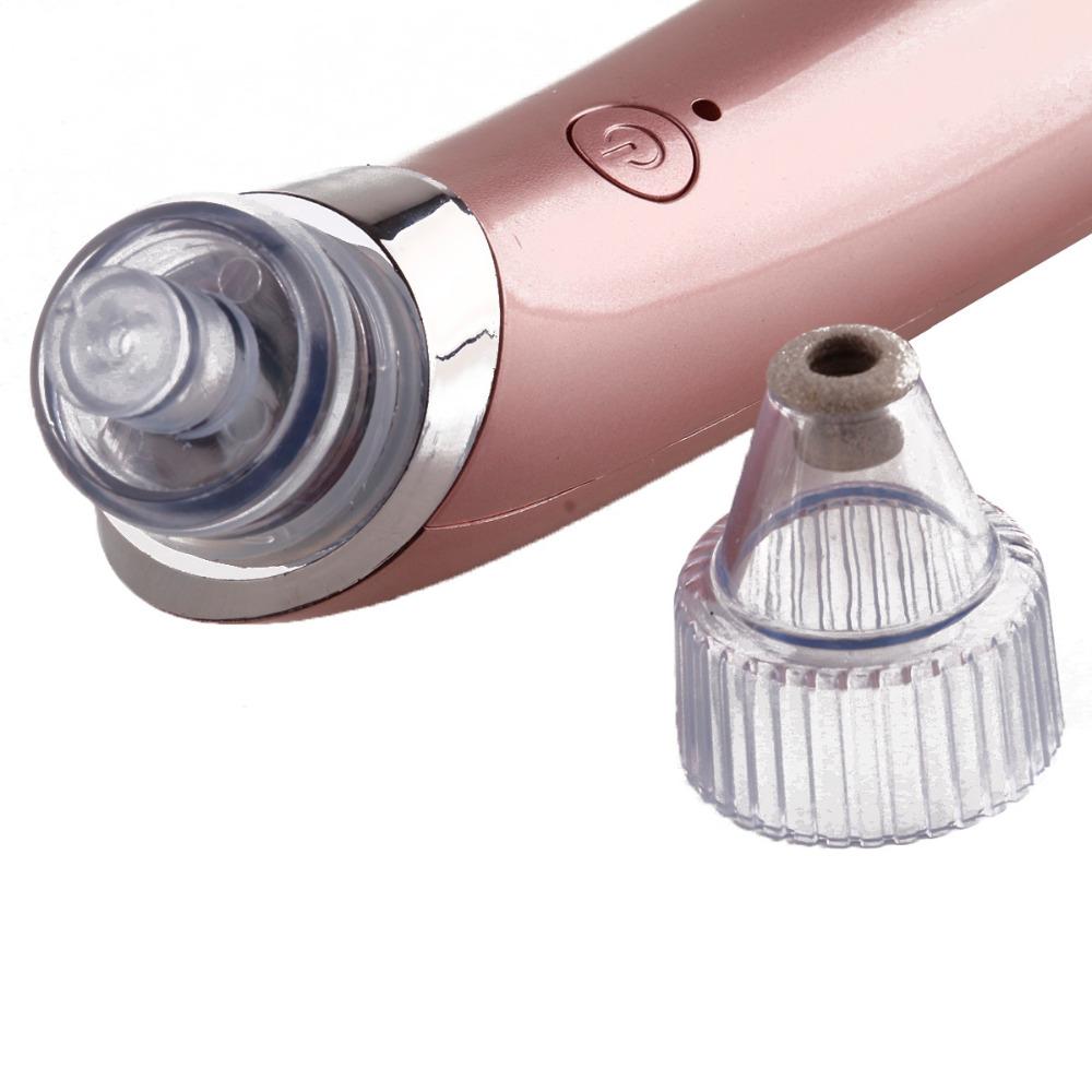 Electric blackhead remover