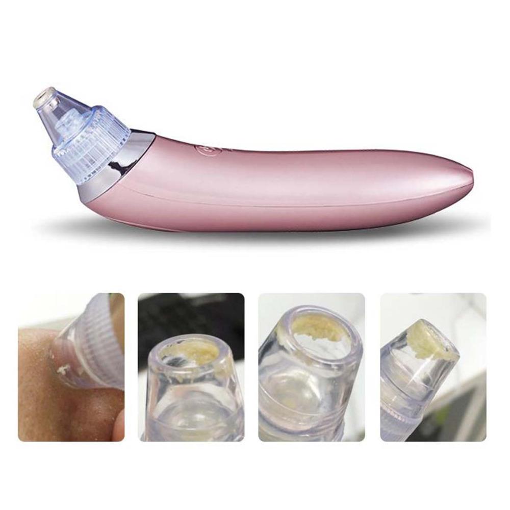 Electric blackhead remover